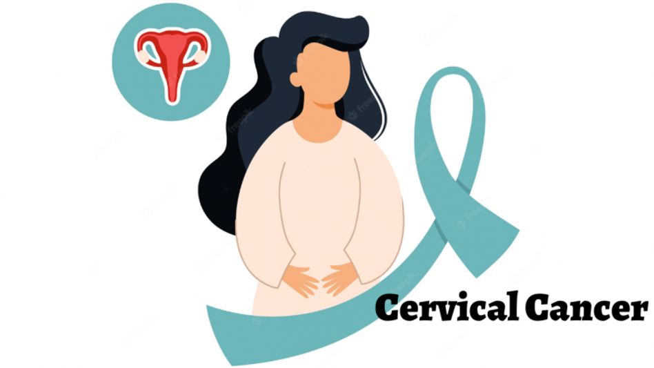 Cervical Cancer Cervical Cancer