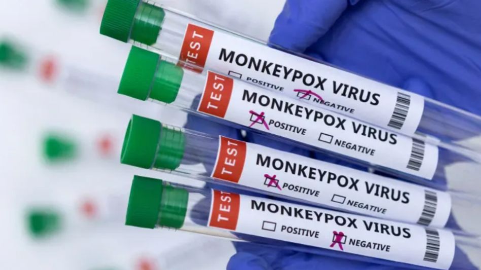Monkeypox spread Monkeypox spread