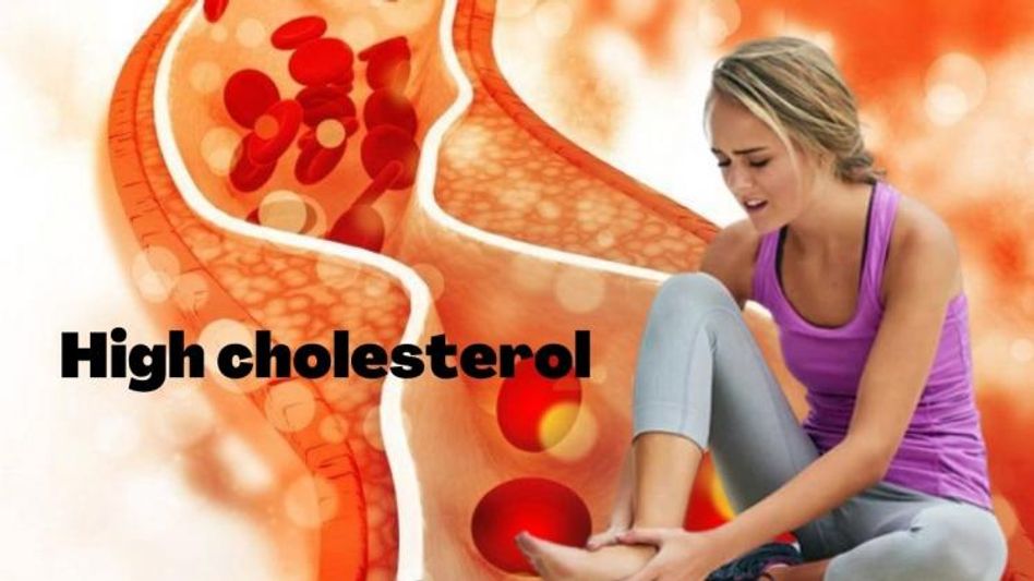 High cholesterol High cholesterol