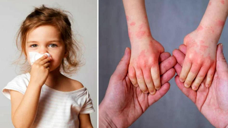 Tomato Fever Tomato Fever