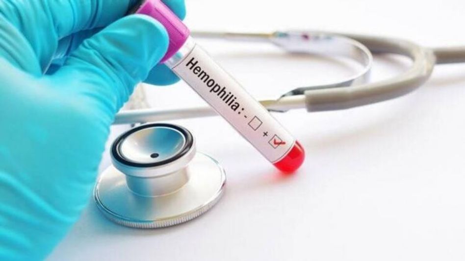hemophilia treatment hemophilia treatment