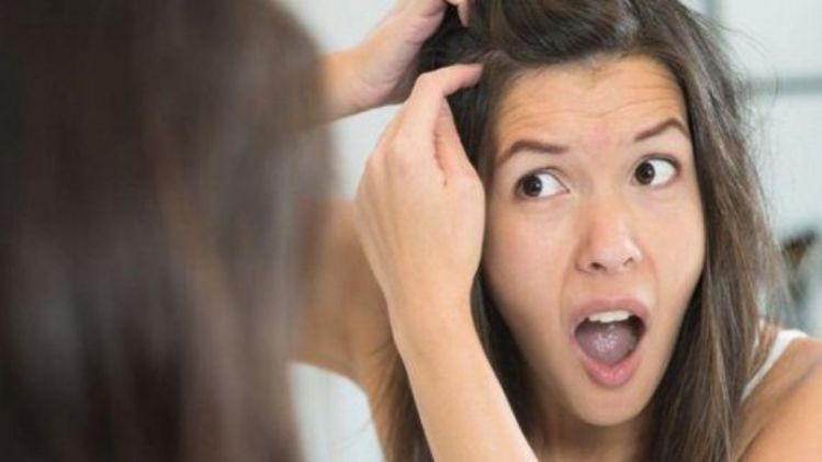 सफेद बालों की समस्या सफेद बालों की समस्या