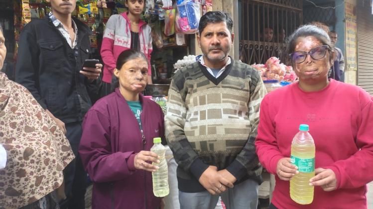 acid attack survivor