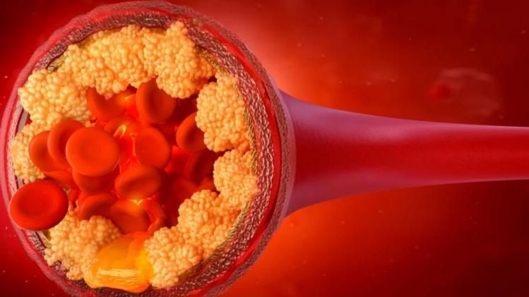 कोलेस्ट्रॉल 