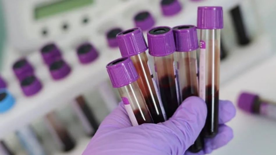 Blood Group A Blood Group A
