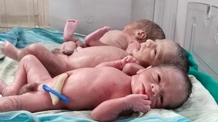 आरा सदर अस्पताल में एक महिला ने 3 बच्चों को जन्म दिया