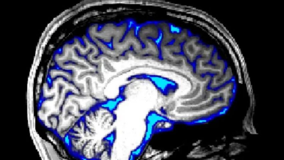 Brain Brain