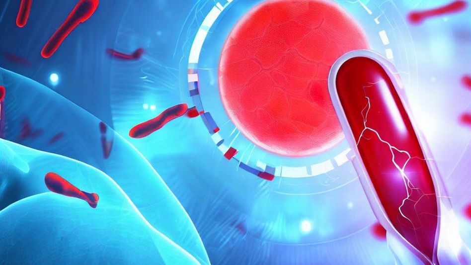 Sickle cell Testing Sickle cell Testing