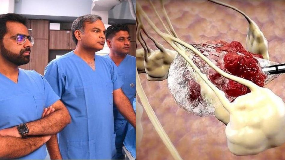 Cancer Treatment Cancer Treatment