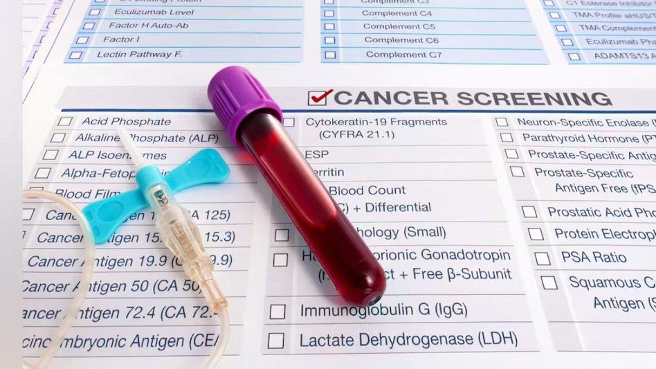 New cancer screening test New cancer screening test