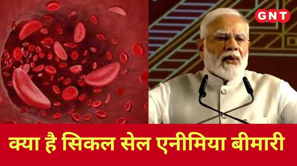 पीएम मोदी ने मध्य प्रदेश में की राष्ट्रीय सिकल सेल एनीमिया उन्मूलन मिशन की शुरुआत पीएम मोदी ने मध्य प्रदेश में की राष्ट्रीय सिकल सेल एनीमिया उन्मूलन मिशन की शुरुआत