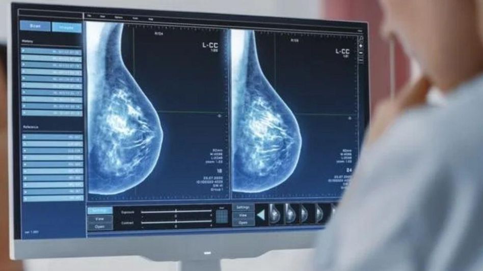 Representational Image Representational Image