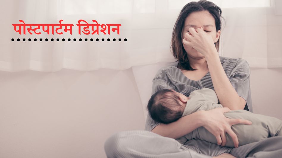 Postpartum depression Drug Postpartum depression Drug