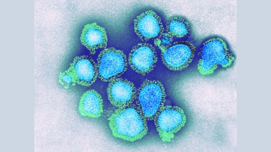 H3N2 Virus H3N2 Virus