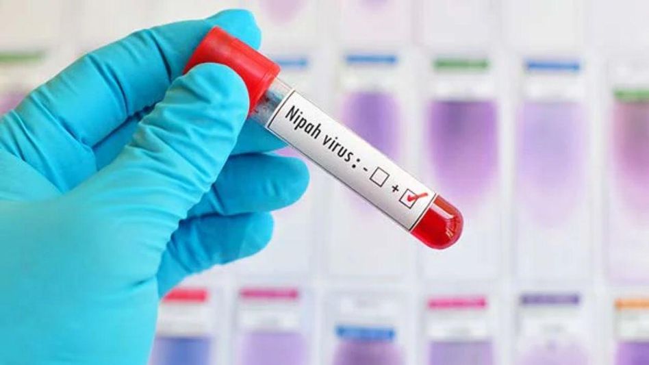 Nipah Virus Nipah Virus