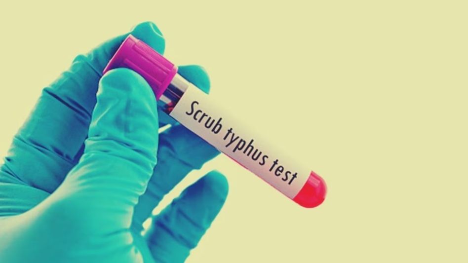 What is Scrub Typhus What is Scrub Typhus