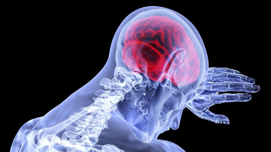World Stroke Day 2023 (symbolic photo) World Stroke Day 2023 (symbolic photo)