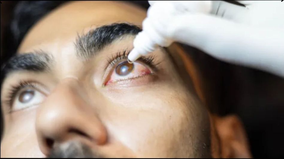 conjunctiva conjunctiva