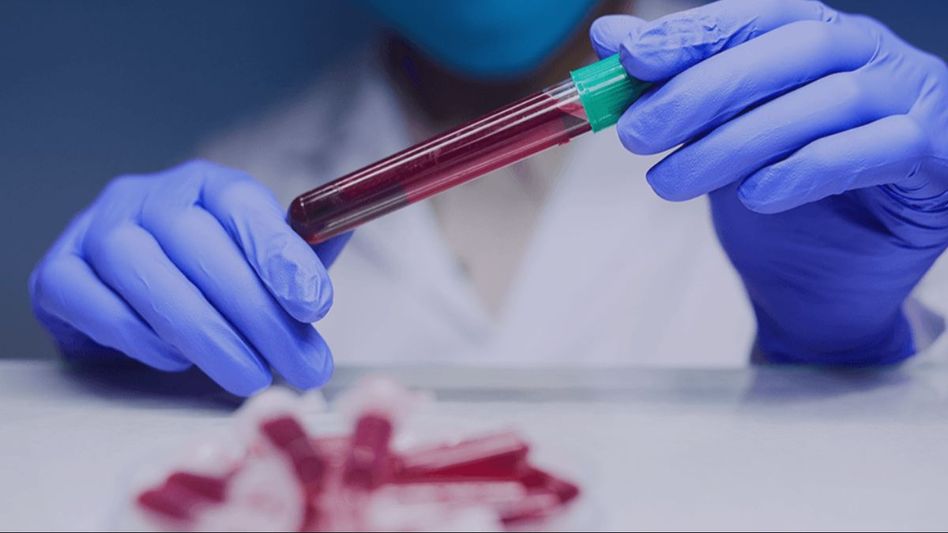 Haemophilia Treatment Haemophilia Treatment