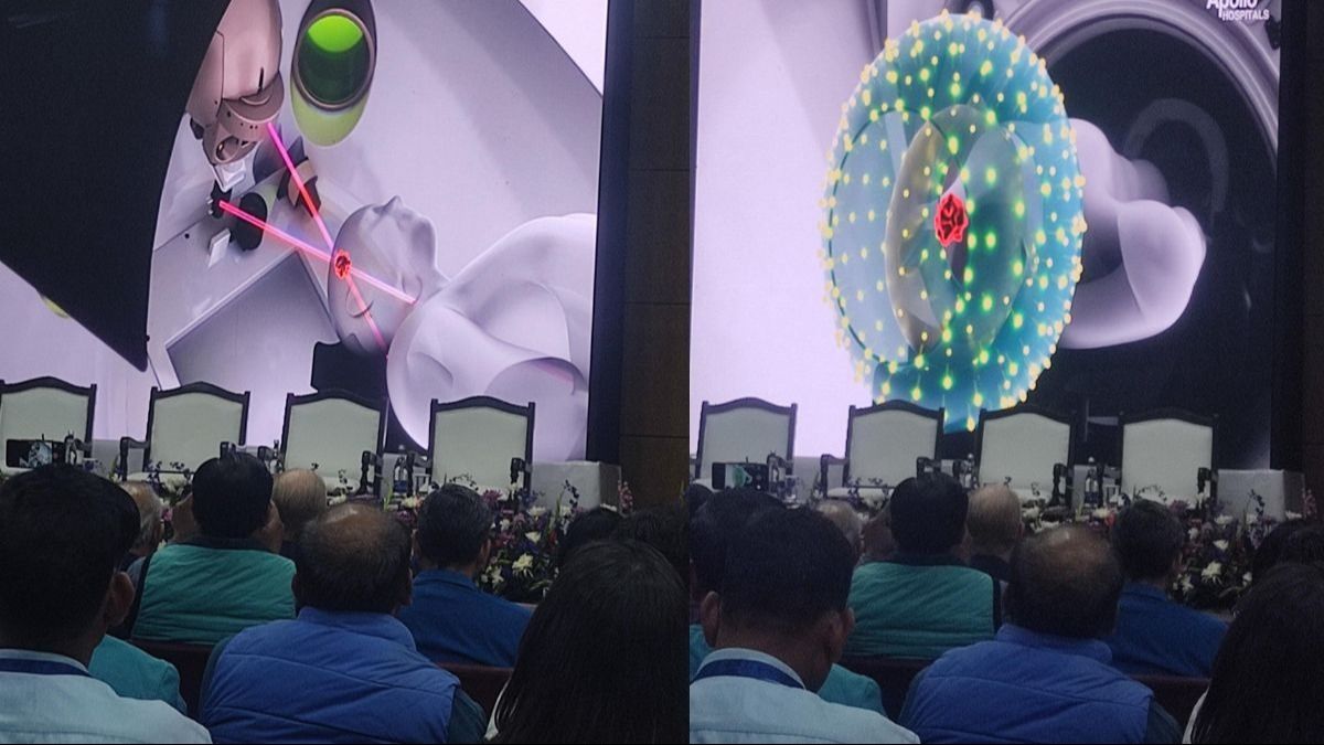 ZAP-X Radiosurgery ZAP-X Radiosurgery