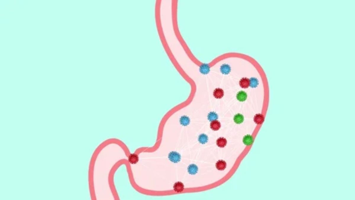 Representational Image Representational Image