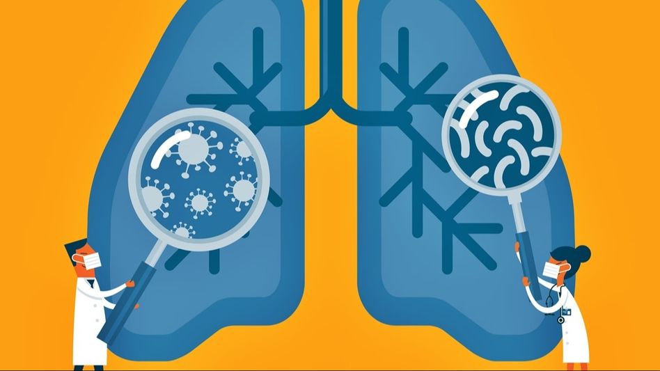 Tuberculosis (India Today) Tuberculosis (India Today)