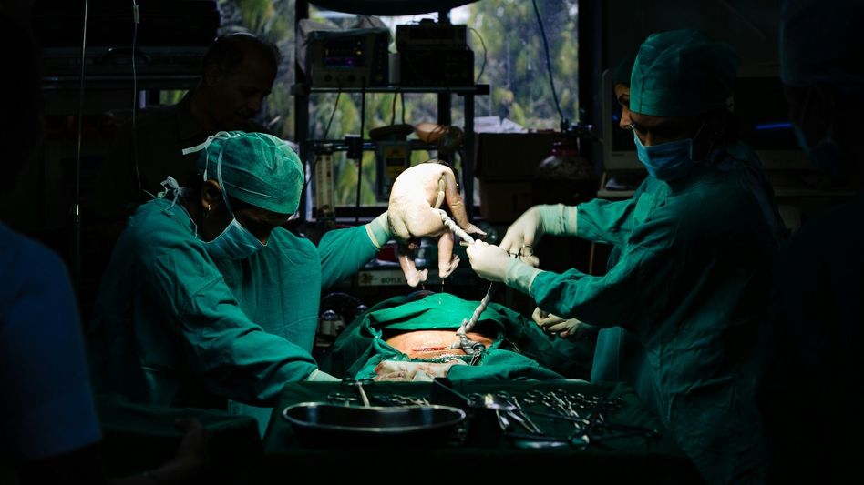 C-section/Photo-Unsplash/Amit Gaur C-section/Photo-Unsplash/Amit Gaur