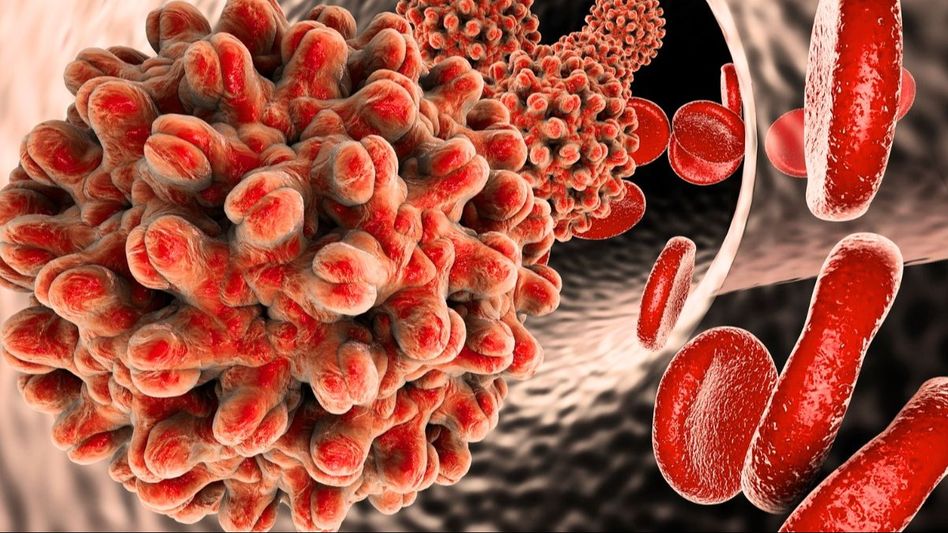 Viral Hepatitis (Photo: Unsplash) Viral Hepatitis (Photo: Unsplash)