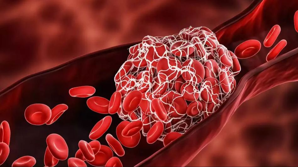 World Hemophilia Day/Unsplash World Hemophilia Day/Unsplash