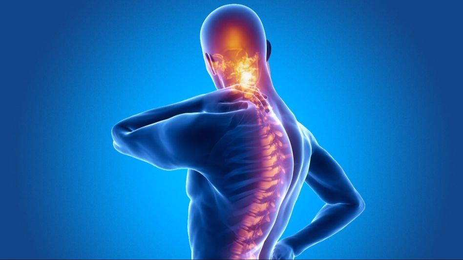 Ankylosing Spondylitis (Photo: Unsplash) Ankylosing Spondylitis (Photo: Unsplash)