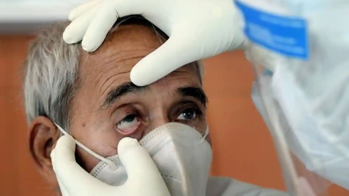 Black Fungus Black Fungus