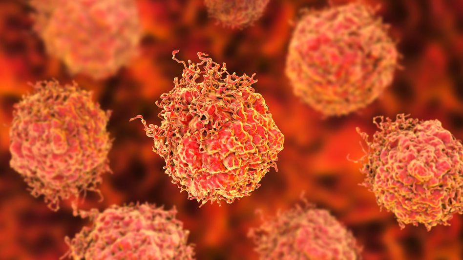 prostate cancer prostate cancer