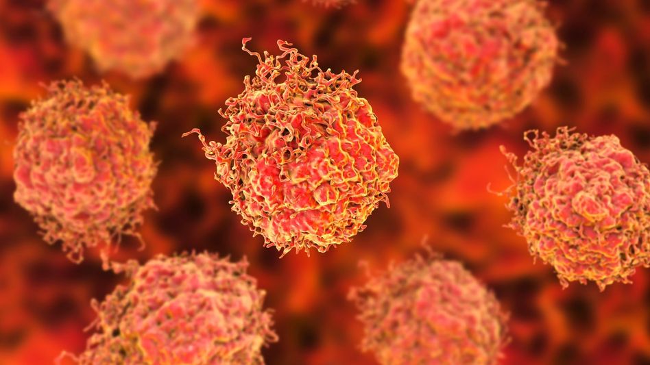 Fasting reduces risk for cancer Fasting reduces risk for cancer