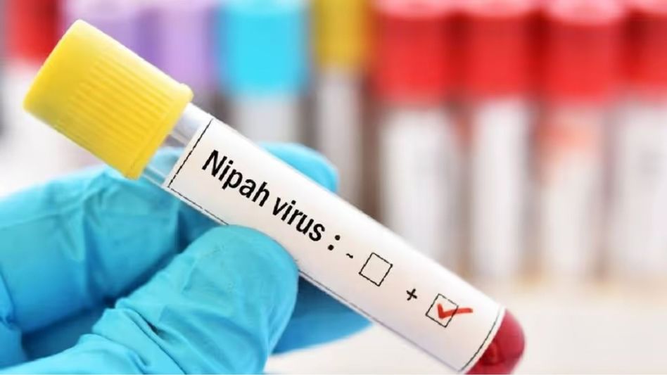 Nipah virus claims life of 14-year-old in Kerala Nipah virus claims life of 14-year-old in Kerala