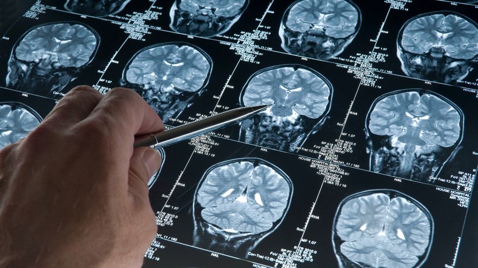 What no one denies is that the two drugs are the most effective Alzheimer's treatments ever -- but their effectiveness is limited. What no one denies is that the two drugs are the most effective Alzheimer's treatments ever -- but their effectiveness is limited.