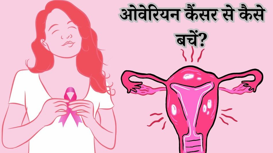 Ovarian cancer (Representative Image) Ovarian cancer (Representative Image)