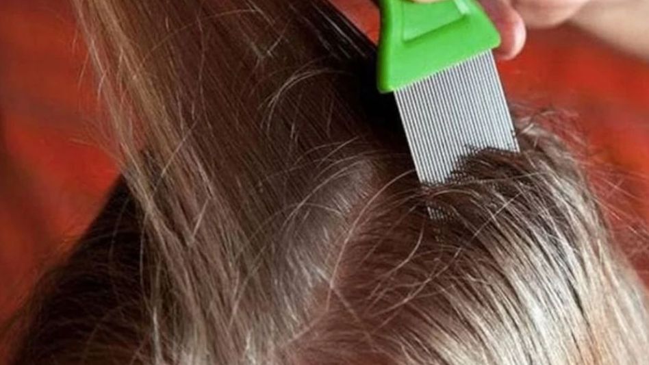 Hair Lice treatment Hair Lice treatment