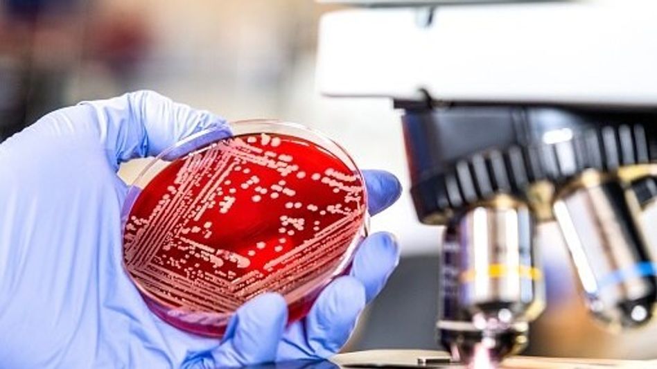 Sepsis Diagnostic Device Sepsis Diagnostic Device