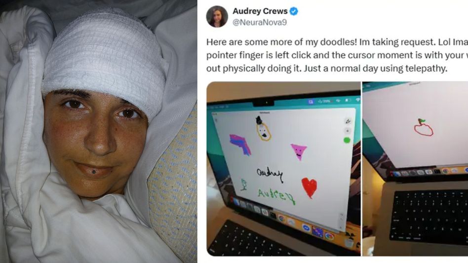 Audrey Crews First Woman To Get Neuralink Chip Audrey Crews First Woman To Get Neuralink Chip