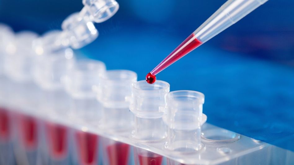 CIRB Blood Group CIRB Blood Group