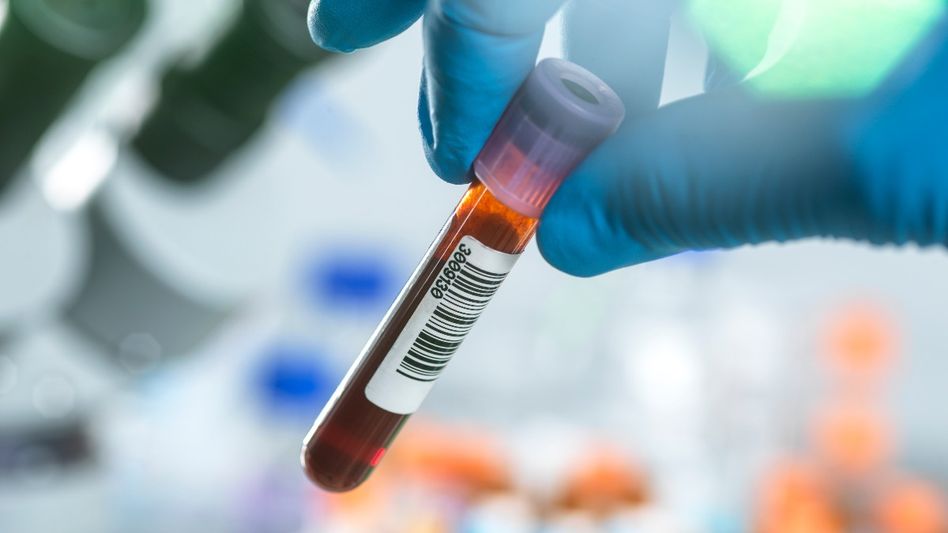 Blood Test Blood Test