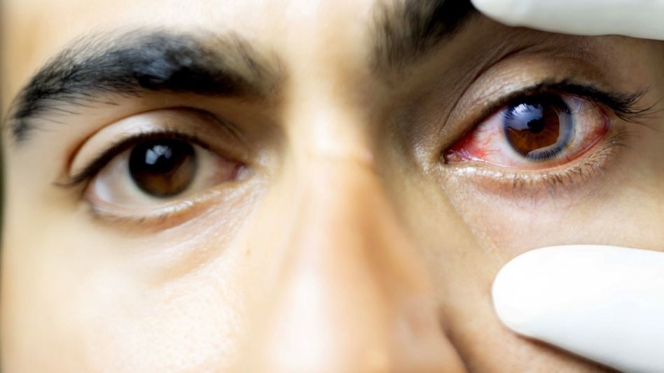 Indian Man With Blurred Vision Indian Man With Blurred Vision