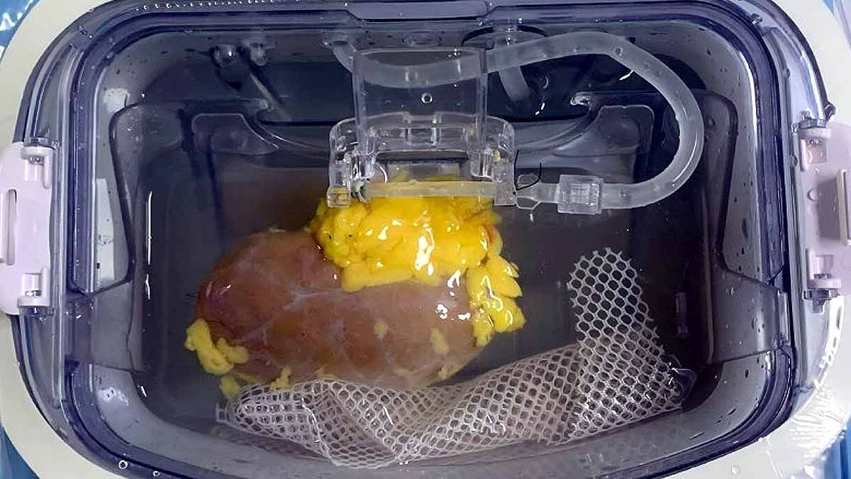 यूनिवर्सल किडनी