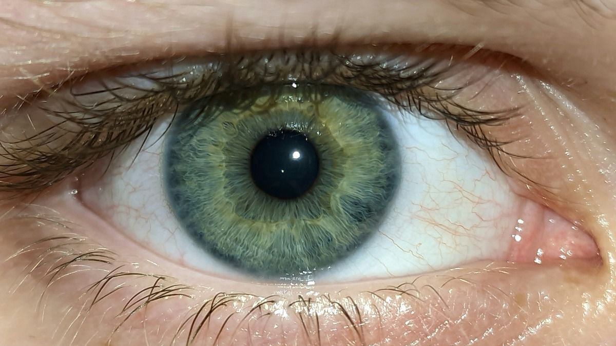 Diabetics eye: Photo: Unsplash