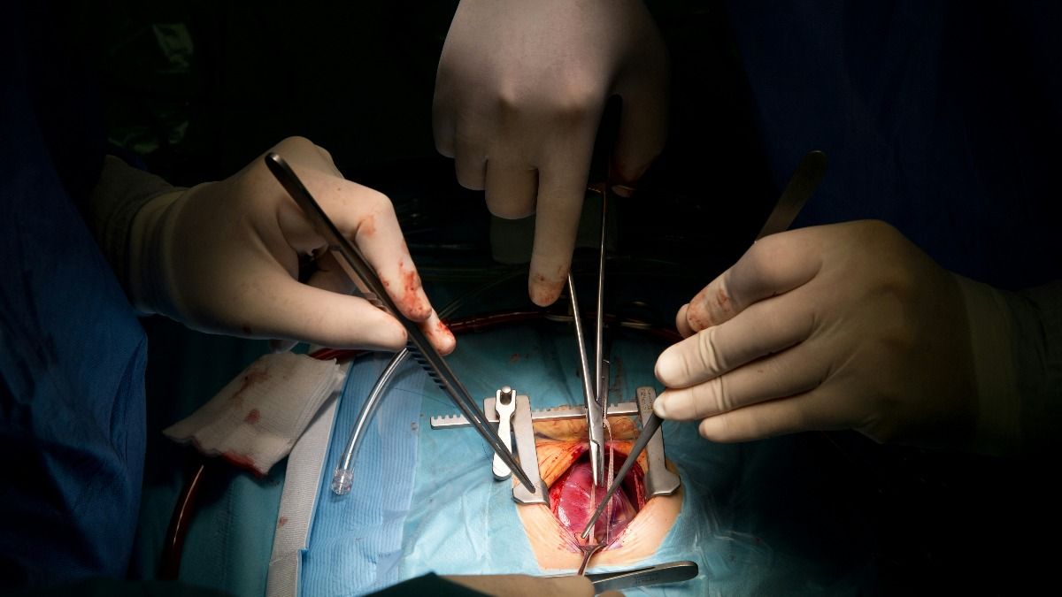 Multi Organ Transplant: Photo: Unsplash