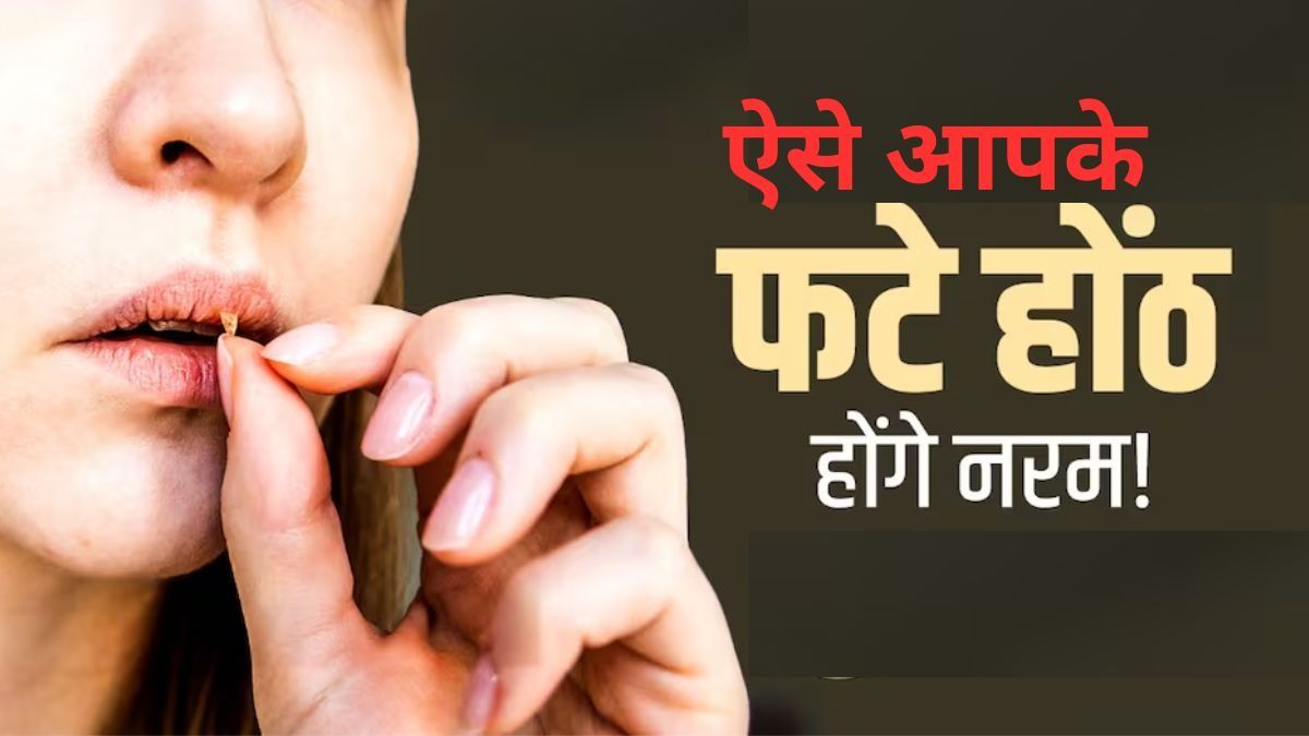 Remedies to Get Rid of Chapped Lips