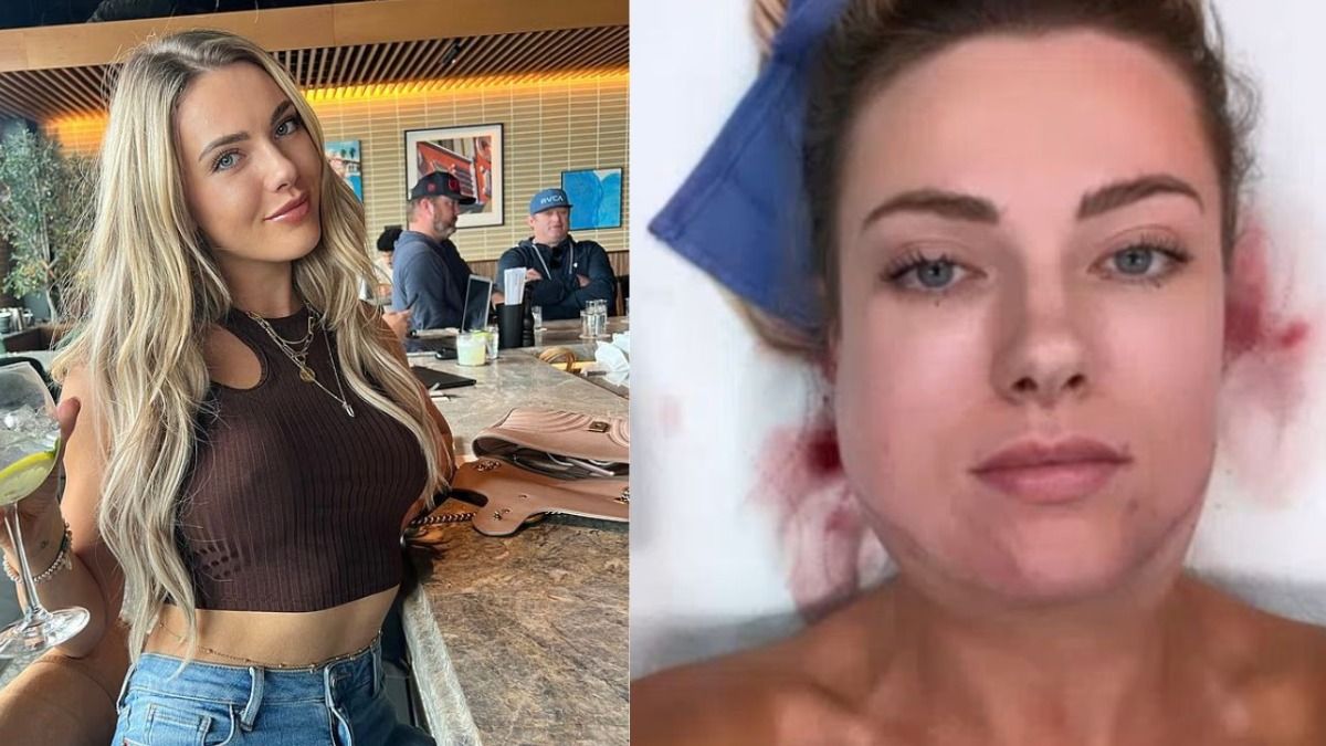 29 वर्षीय एस्पन ब्रुक.