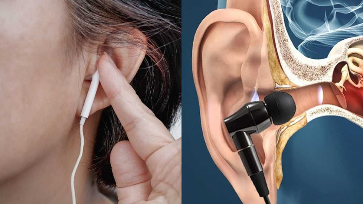 Earphone Side Effects