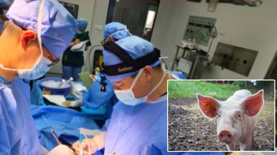 Pig Liver Transplant