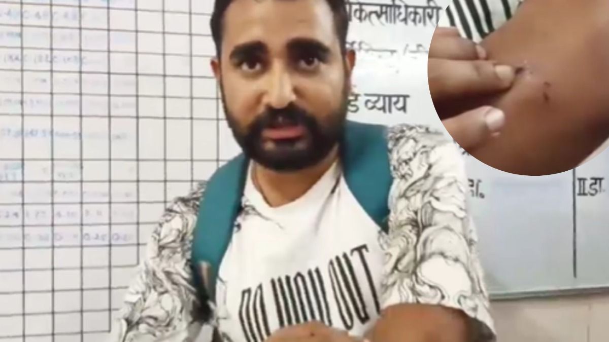 एंटी रेबीज इंजेक्शन लगवाने अस्पताल पहुंचा युवक, डॉक्टर को गुटका चबाते देख डायल किया 112